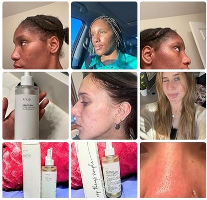 ODM Heartleaf kiểm soát lỗ chân lông ẩm mặt làm sạch dầu cho mặt trang điểm loại bỏ mụn đầu đen 6,76 Fl Oz